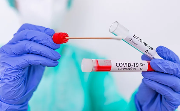 В Якутии за сутки выявлено 172 новых случая коронавирусной инфекции